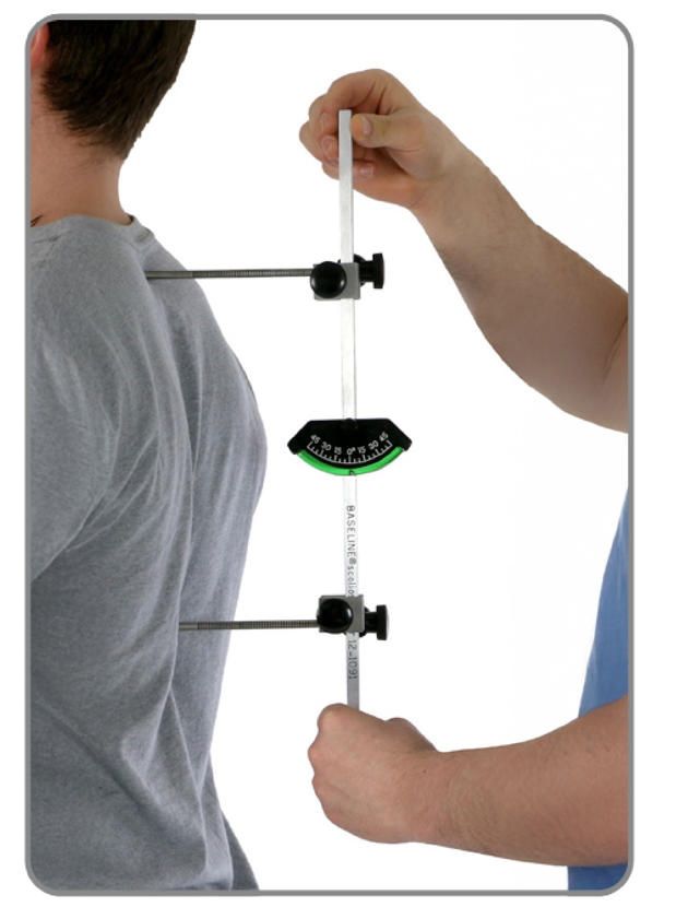 脊柱侧弯测量器