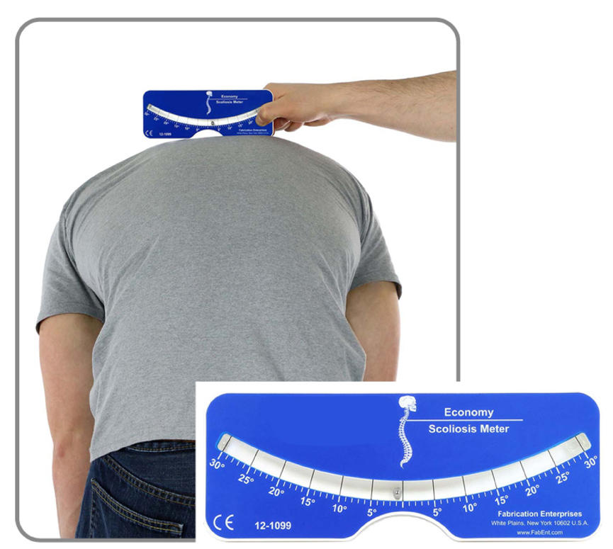 简易式脊柱侧弯测量器