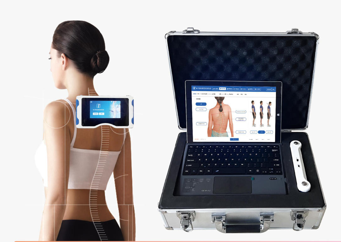 电子脊柱侧弯检测系统